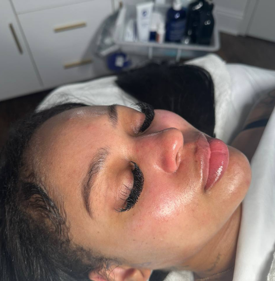 Hydrafacial Treatment
