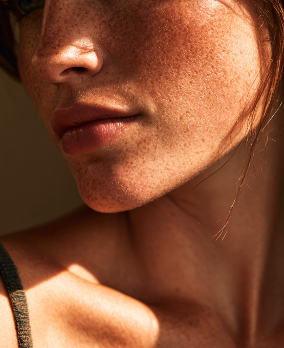 Sun-Kissed Sun-Kissed skin